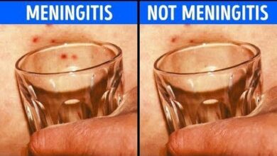اختبار كأس الماء لكشف التهاب السحايا