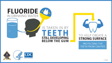 أهمية الفلور للأسنان