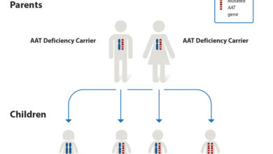 نقص ألفا-1 أنتيتريبسين 19 عوز ألفا-1 أنتيتريبسين