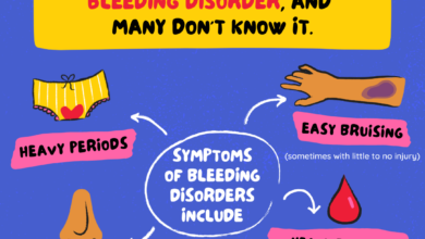 13 هي أنواع النزيف 17 اسباب أنواع النزيف