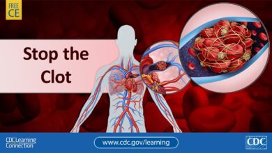 تخثر الدم: 6 أسباب 18 أعراض تخثر الدم