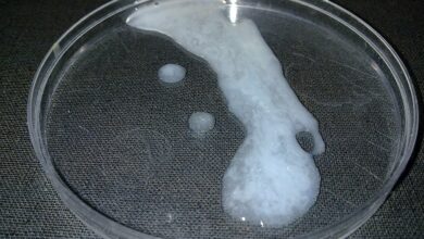 السائل المنوي الطبيعي: 9 مواصفات 21 السائل المنوي الطبيعي