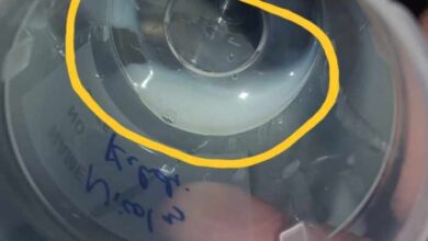 شكل ماء الرجل السليم بالصور: 1.5 حتى 5 مل 20 شكل المني السليم بالصور