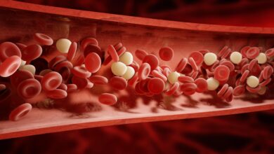 التخثر المنتشر داخل الأوعية: 5 أسباب 18 التخثر المنتثر داخل الأوعية الدموية