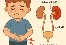 التهاب الحويضة و الكلية عند الأطفال والرضع 25 التهاب الحويضة و الكلية للاطفال