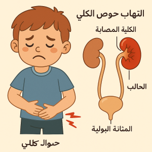التهاب الحويضة و الكلية عند الأطفال والرضع 13 التهاب الحويضة و الكلية للاطفال