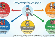الأمراض التي يكشفها CRP فحص