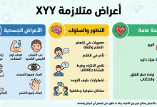 اعراض متلازمة جاكوب