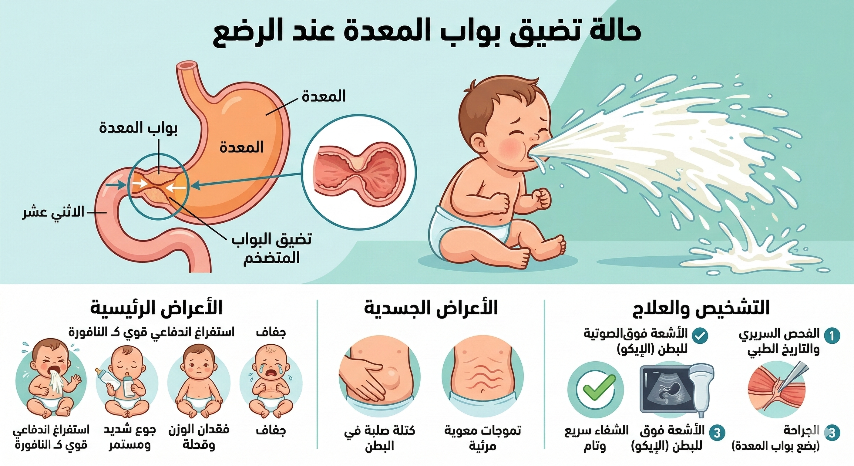 استفراغ الرضيع مثل النافورة 1