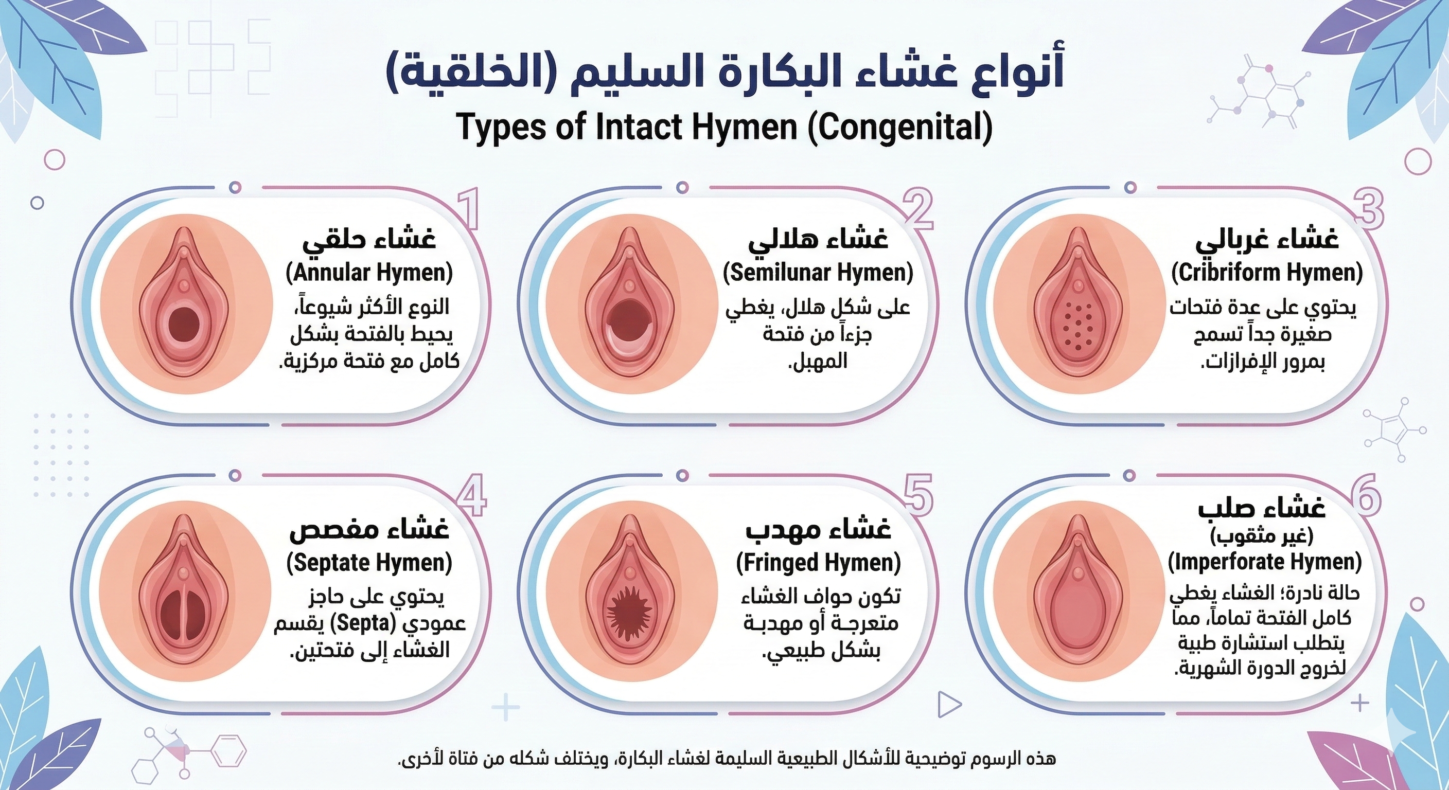 شكل غشاء البكارة السليم بالصورة 1
