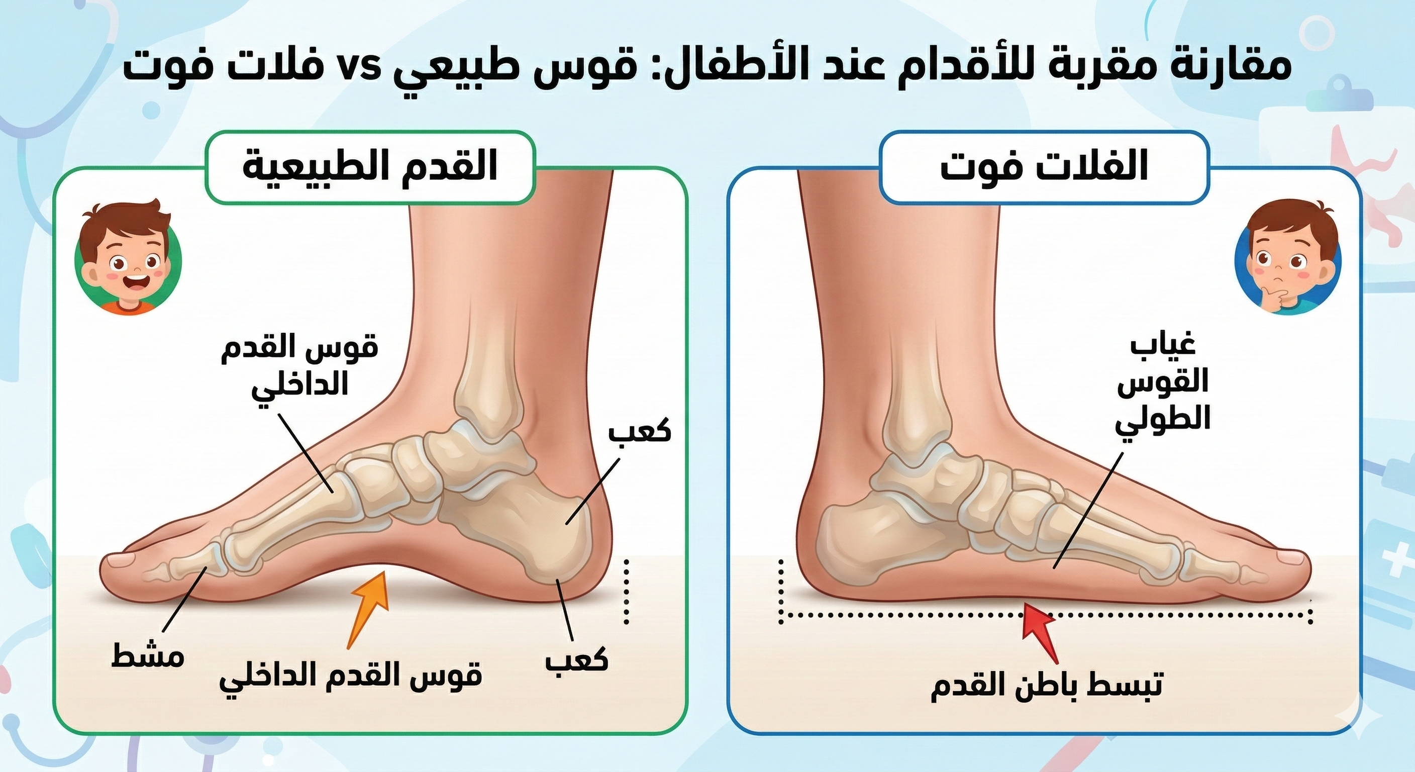 فلات فوت القدم المسطحة 1