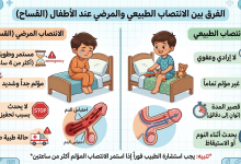 الانتصاب عند الاطفال والرضع والقساح