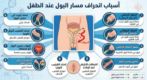 انحراف مسار البول