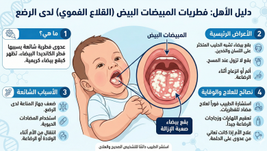 فطريات الفم عند الرضع