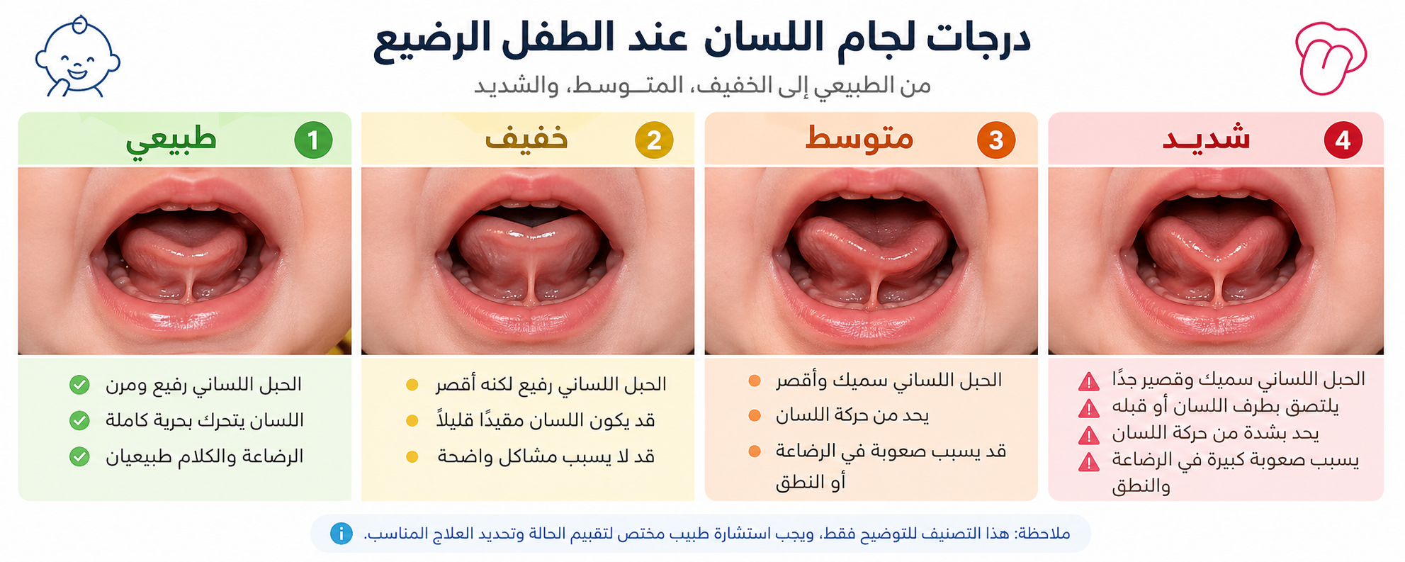 اللسان المربوط 1