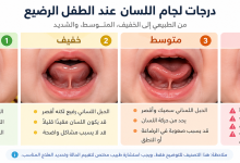 اللسان المربوط