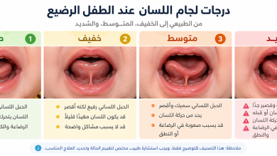 اللسان المربوط