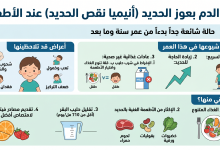 فقر الدم بنقص الحديد