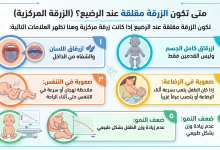 اسباب ازرقاق الأرجل عند الرضيع