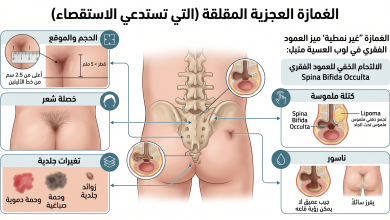 الغمازة العجزية