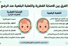 شعر الطفل الرضيع الخفيف