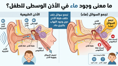 ماء خلف طبلة أذن الطفل